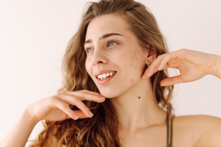 Avez-vous une tache de naissance ? Cela pourrait être une cicatrice de votre vie passée